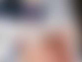 Investigan un presunto caso de viruela del mono en Huaraz