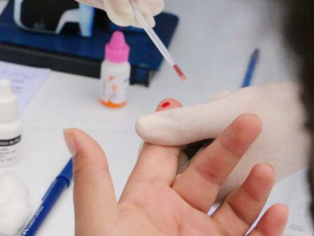 Investigan un presunto caso de viruela del mono en Huaraz