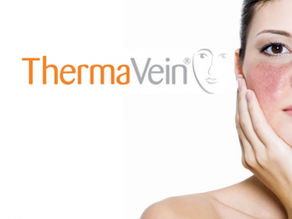 What is the best treatment for red veins and thread veins?