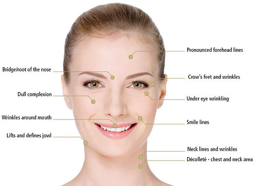 A LIFT FACIALS