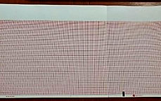 PAPEL TERMICO EN ROLLO CUADRICULADO, PLEGADO EN Z TRAZO ECG ELECTROCARDIOGRAFO PAPEL ALTA CALIDAD MONITORES DE SIGNOS VITALES ELECTROCARDIOGRAFOS DESFIBRILADORES TOCOCARDIOGRAFOS ELECTRO SOLUCIONES MEDICAS