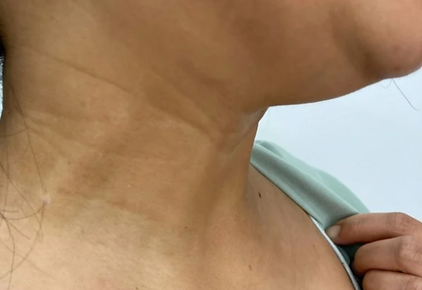 side of the neck and chin