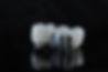 In dental and cosmetic dentistry, bone-anchored dental implant treatment with porcelain br
