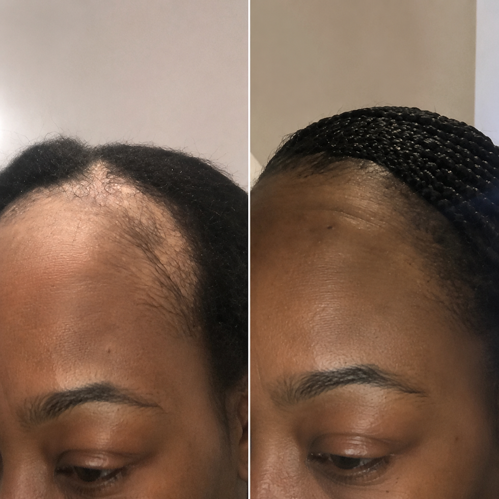 Thumbnail: Full Hair Growth Experience Ritual