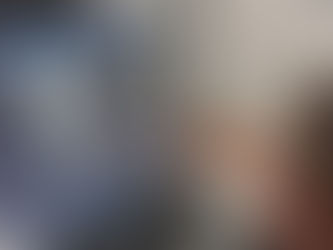 Nova aquisição no HGLAS: aparelho CR para revelação digital de imagens do Raio-X