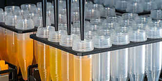 An image of Serum samples