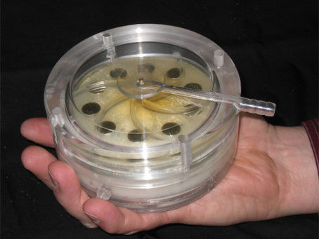 Artificial Wearable Lung to Help Patients be Mobile Before Transplant