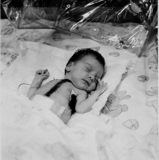 Baby Fae
