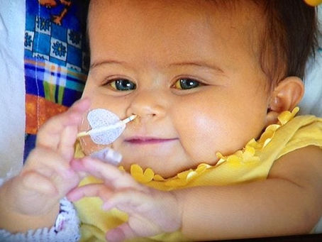 Art auction helps Portland baby who needs liver transplant – kgw.com