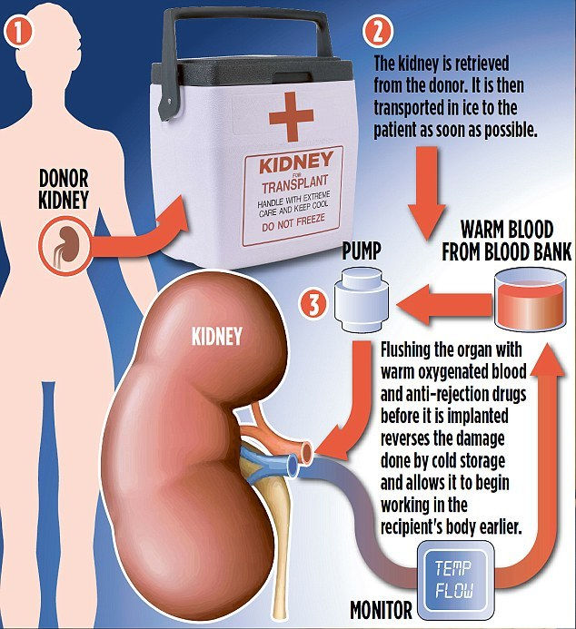 Doctors hope that the remarkable procedure – known as normothermic perfusion – will help slash waiting lists by ten per cent over the next five years
