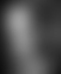 Happy 60th Birthday: The science that makes transplantation work | OUPblog