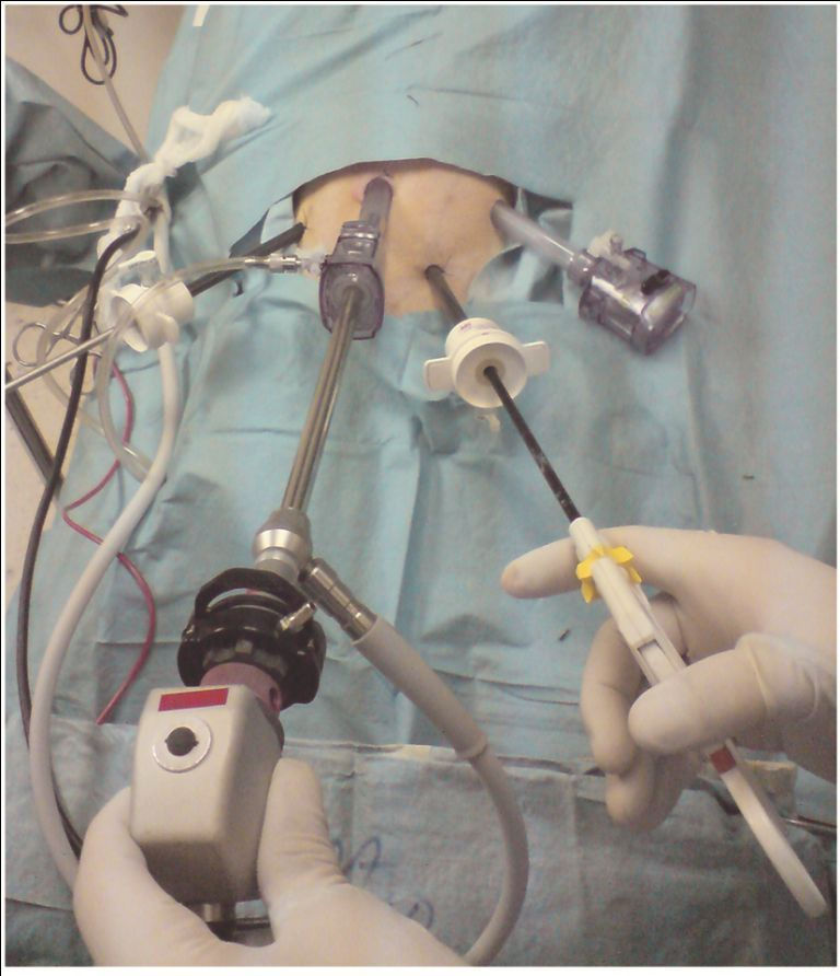 Fig1
