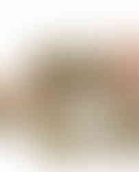 Gold platform slingback pumps with 9.5CM spike heels and slip-on closure.