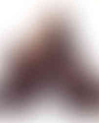 Gold platform slingback pumps with 9.5CM spike heels and slip-on closure.