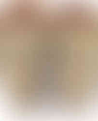 Gold platform slingback pumps with 9.5CM spike heels and slip-on closure.