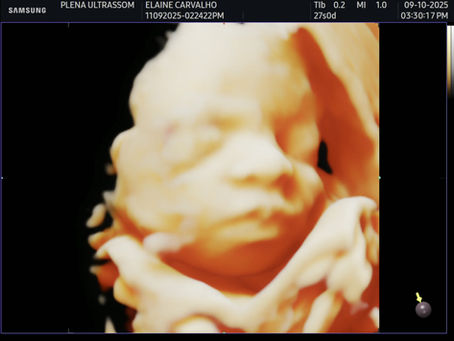 Quando fazer cada ultrassom da gestação?