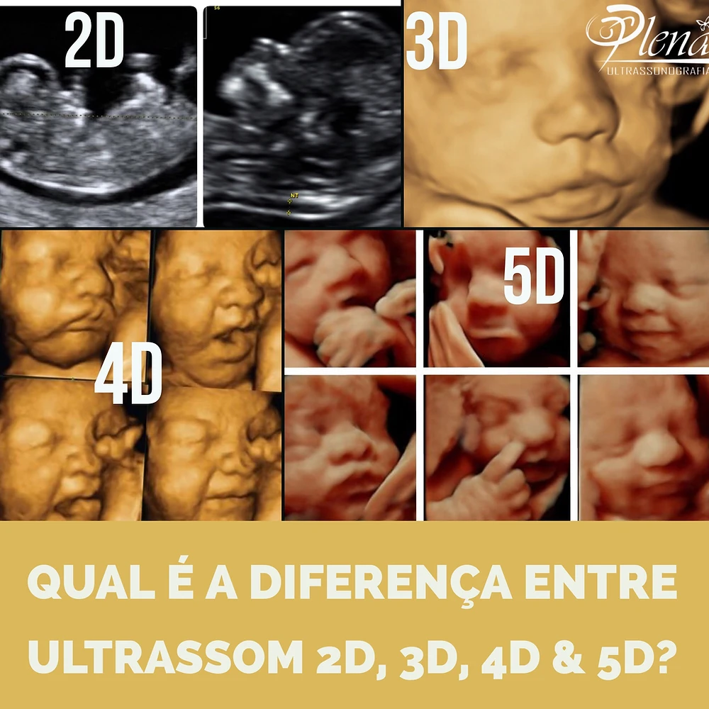 Qual E A Diferenca Entre Ultrassom 2d 3d 4d 5d