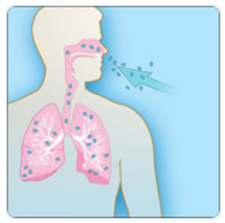 Diagram of a human silhouette with lungs and throat shown in pink, illustrating air inhalation of anthrax, set against a blue background.