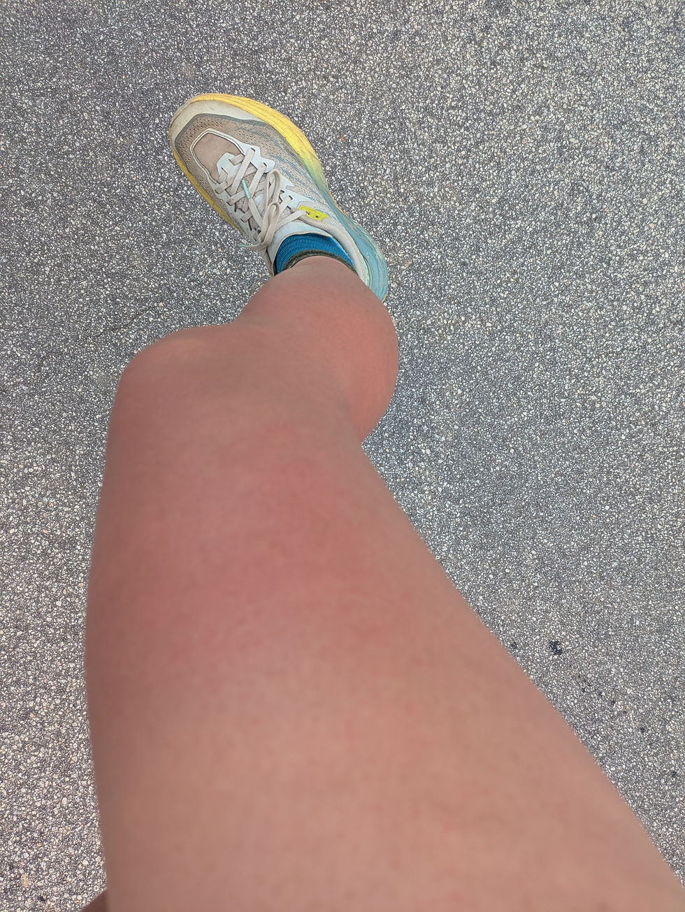 Sunburned leg from hiking in full sun on Fisherman’s Trail Portugal Day 4