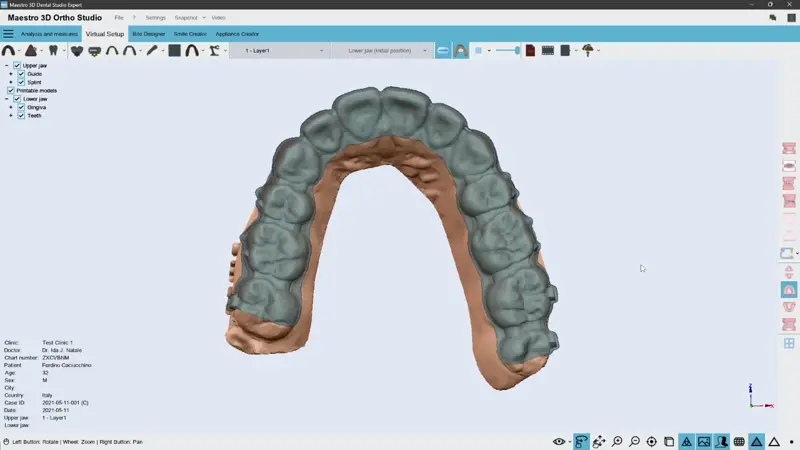 maestro3d.dental.studio.directly.3d.printed.clear.aligners2.webp