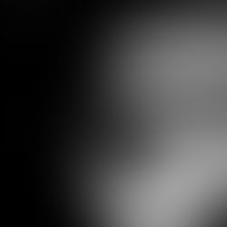 One Simple Reason Anxiety is Getting the Best of our Young People