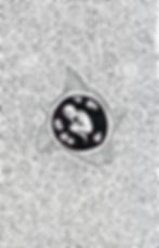 Black-and-white abstract drawing of a curled seated figure in a dark circle, surrounded by radiating lines and spiral patterns.