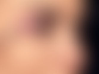 Kocaeli Kirpik Lifting