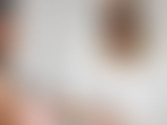 İzmit'te Lazer Epilasyonun Popülaritesi Artıyor