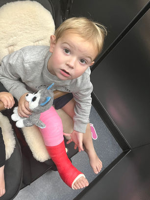 How to Survive your Toddler's Broken Leg