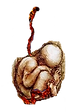 fetus 2.png
