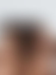 Tattooing Melanated Skin