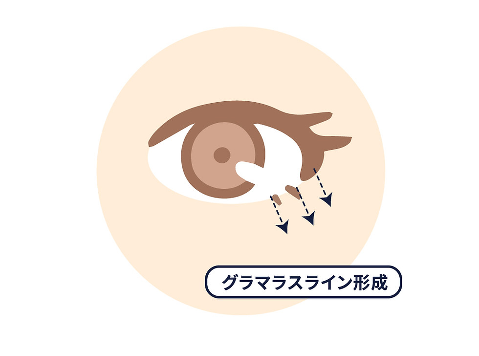 タレ目形成.jpg