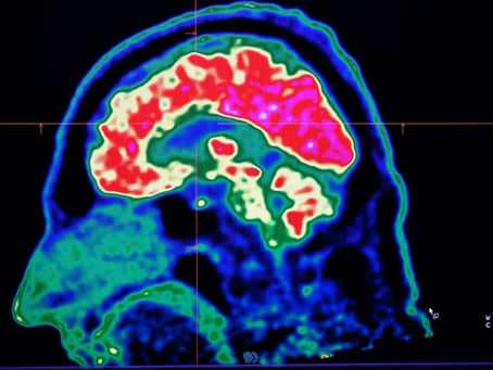 Microplastics are everywhere, but data is still lacking about how they could be affecting our brains (Fred TANNEAU) (Fred TANNEAU/AFP/AFP)