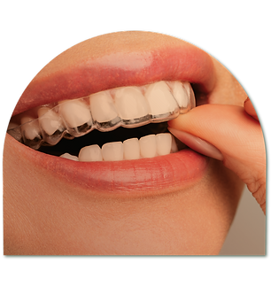 Servicos_odontologicos_clinica_conceito_ortodontia_invisalign.png