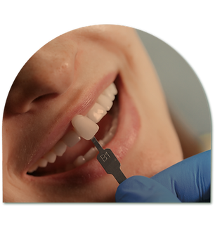 Servicos_odontologicos_clinica_conceito_clareamento.png