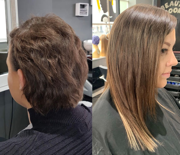 Hair extensions for 6 months post-chemotherapy