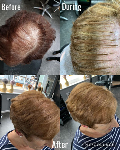 Hair in Recovery extensions for thinning hair