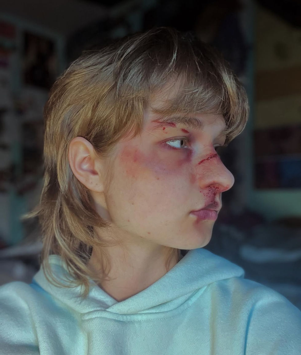 Facial lacerations, nose bleeds, bruising SFX 