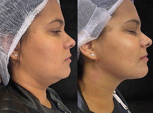 Beige Minimalist Skincare Before and After Instagram Post.png.jpg