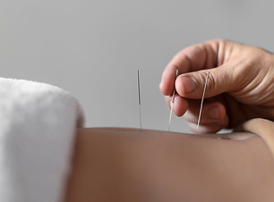 close-up-hand-holding-acupuncture-needle.jpg