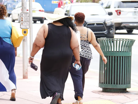 Lipedema ou obesidade? Especialista aponta diferenças entre os quadros