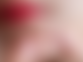 Consumir chocolate pode causar espinhas? Saiba mais