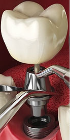 modadental-9.jpg