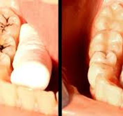 Adult's Restorative Dentistry.jpg