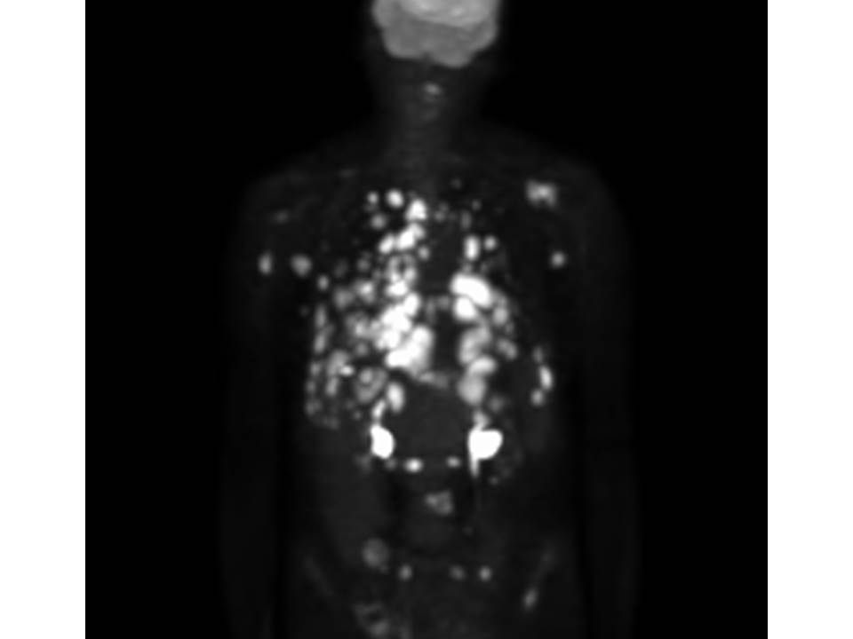 Sometimes no matter what I do, I can’t win…