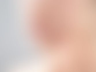 【ほうれい線】を薄くする３つの方法 ！老け顔を撃退して若返ろう