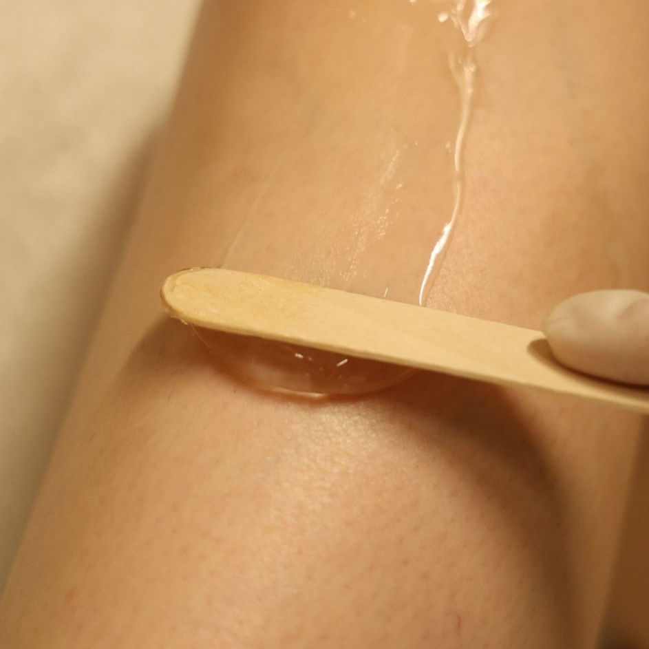 Laserepilatsiooni intervallid