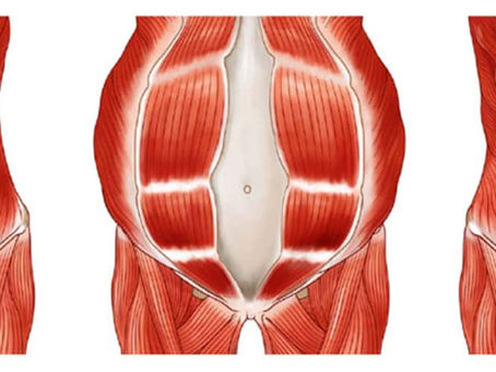 Rectus Diastase - Wie fange ich am besten effektiv mit der Rückbildung an?