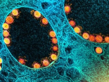 França identifica nova variante do coronavírus com mais de 40 mutações