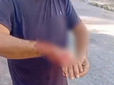 Pitbull escapa de casa, ataca homem e mata cadela em MT